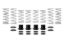 Picture of Eibach Coil Spring Set - E85-209-005-02-22