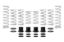 Picture of Eibach Coil Spring Set - E85-209-009-02-22