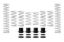 Picture of Eibach Coil Spring Set - E85-209-018-02-22
