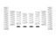 Picture of Eibach Coil Spring Set - E85-212-002-03-22