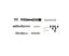Valve Body Repair Kit ZF 8HP Gen-1 Valve Body